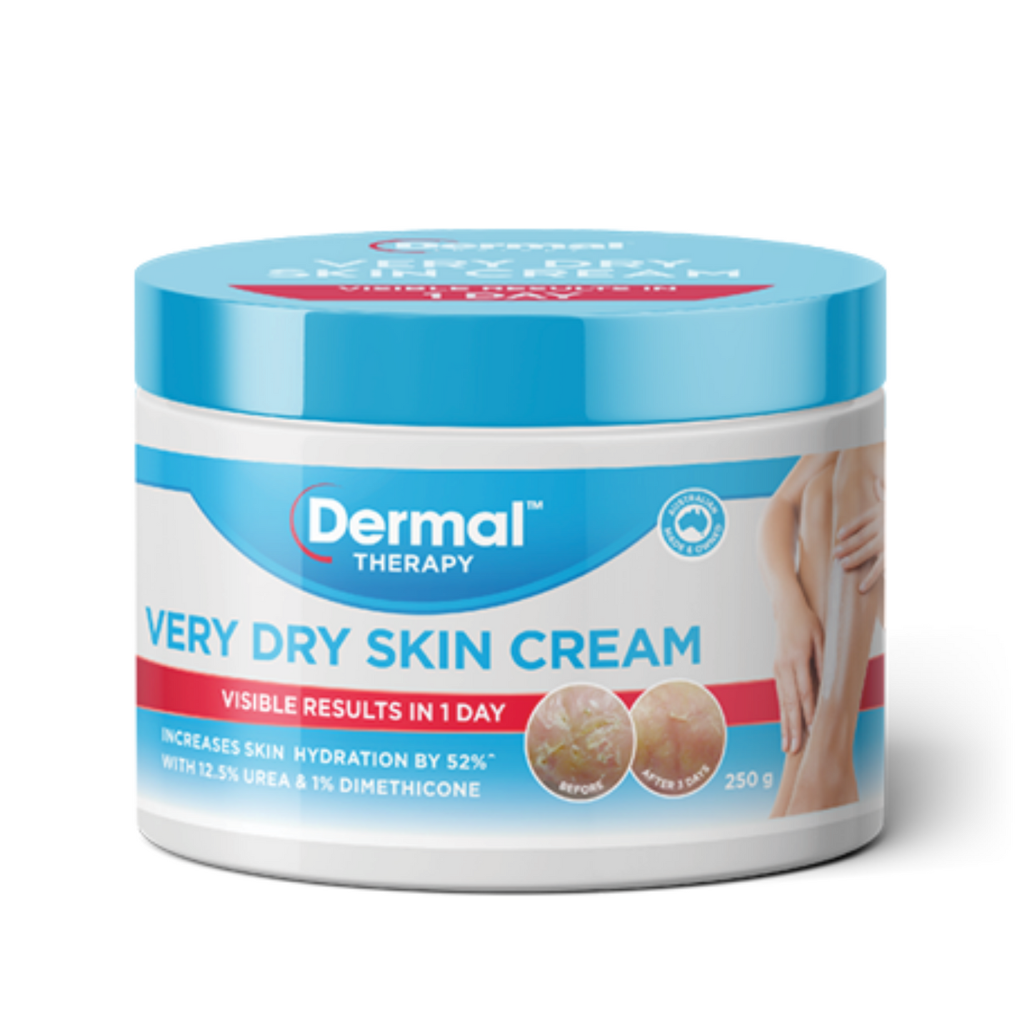 Dermal Therapy Very Dry Skin Cream 250g